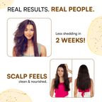 Hair Growth Serum with Redensyl, Anagain, Procapil & Capilia Longa