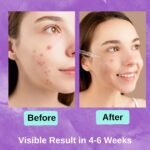oregocare salicylic acid serum